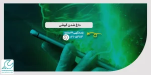 داغ شدن گوشی