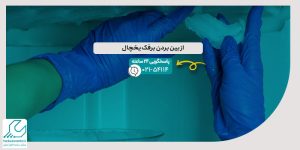 از بین بردن برفک یخچال